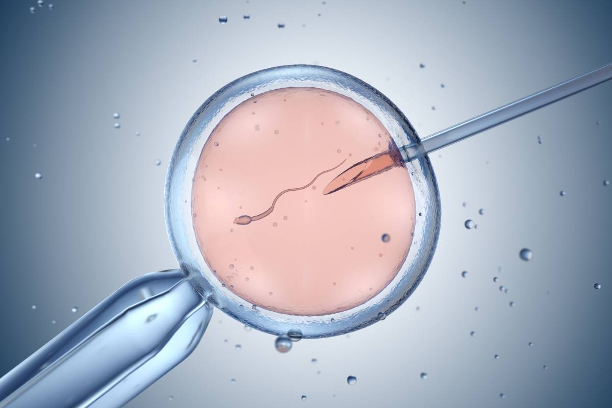 Research on The Impacts of Anesthesia on IVF Outcome
