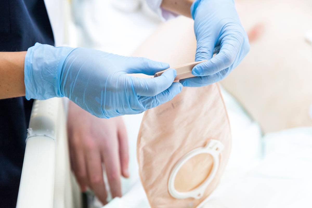 Anesthesia for Ostomy Surgery
