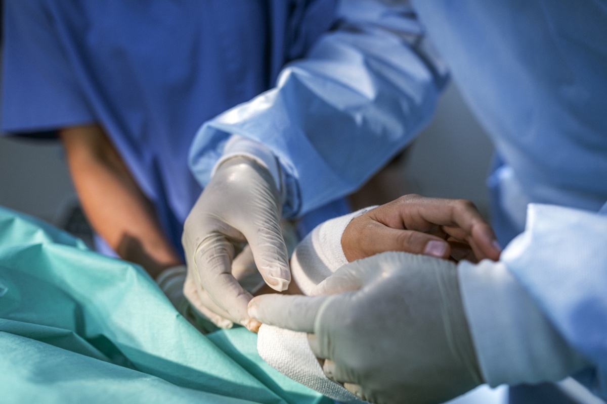 Motor-Sparing Peripheral Nerve Blocks for Hand Surgery