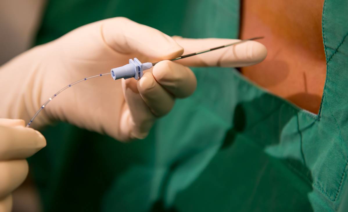 Motor-Sparing Nerve Blocks