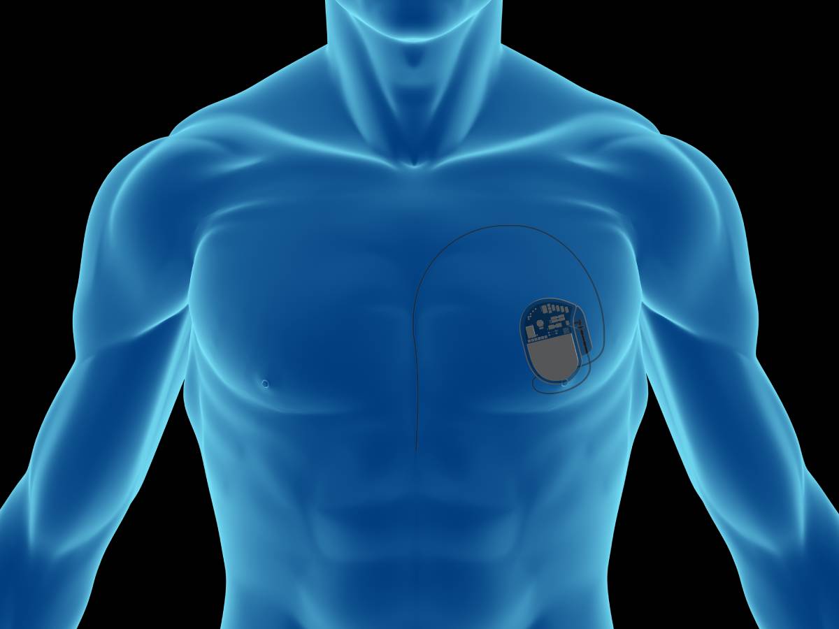 Cardiology Procedures in the Outpatient Setting