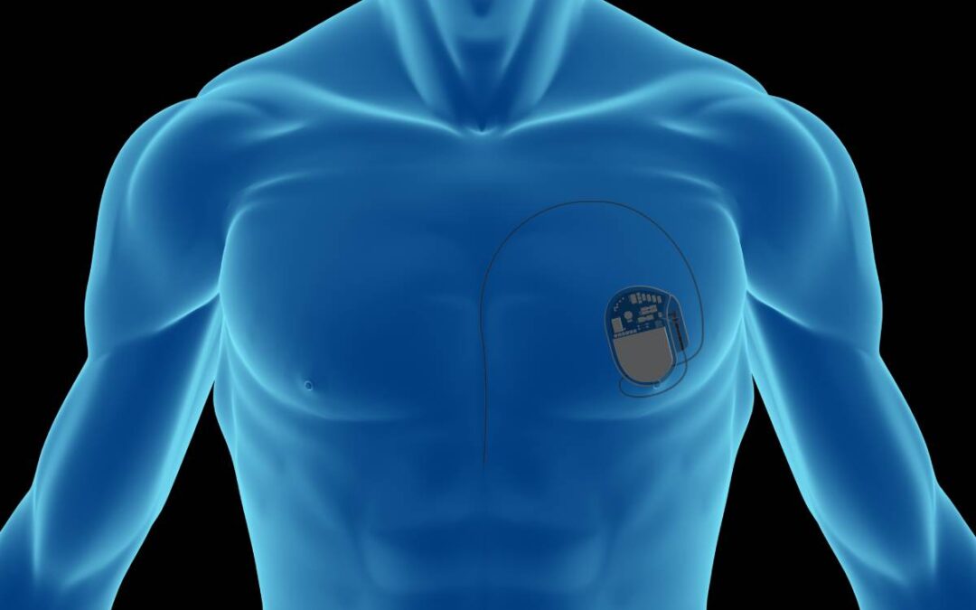 Cardiology Procedures in the Outpatient Setting