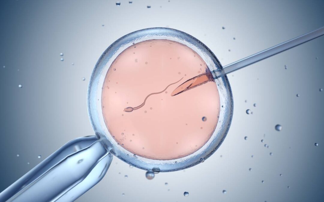 Research on The Impacts of Anesthesia on IVF Outcome