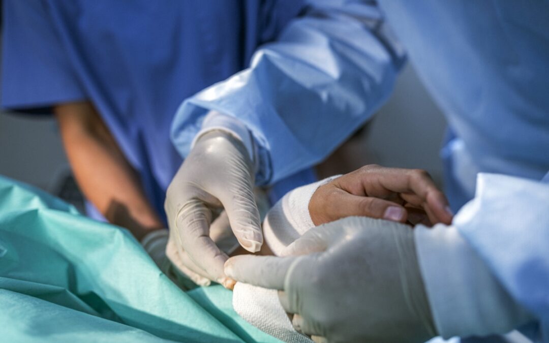 Motor-Sparing Peripheral Nerve Blocks for Hand Surgery